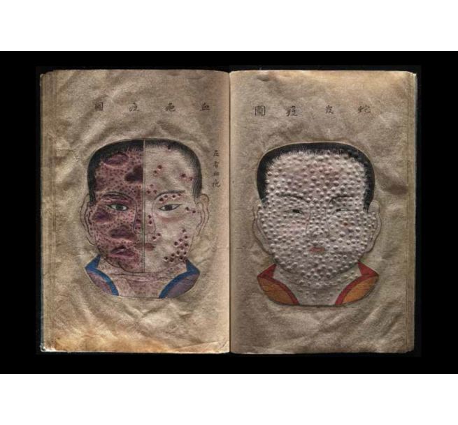 book1